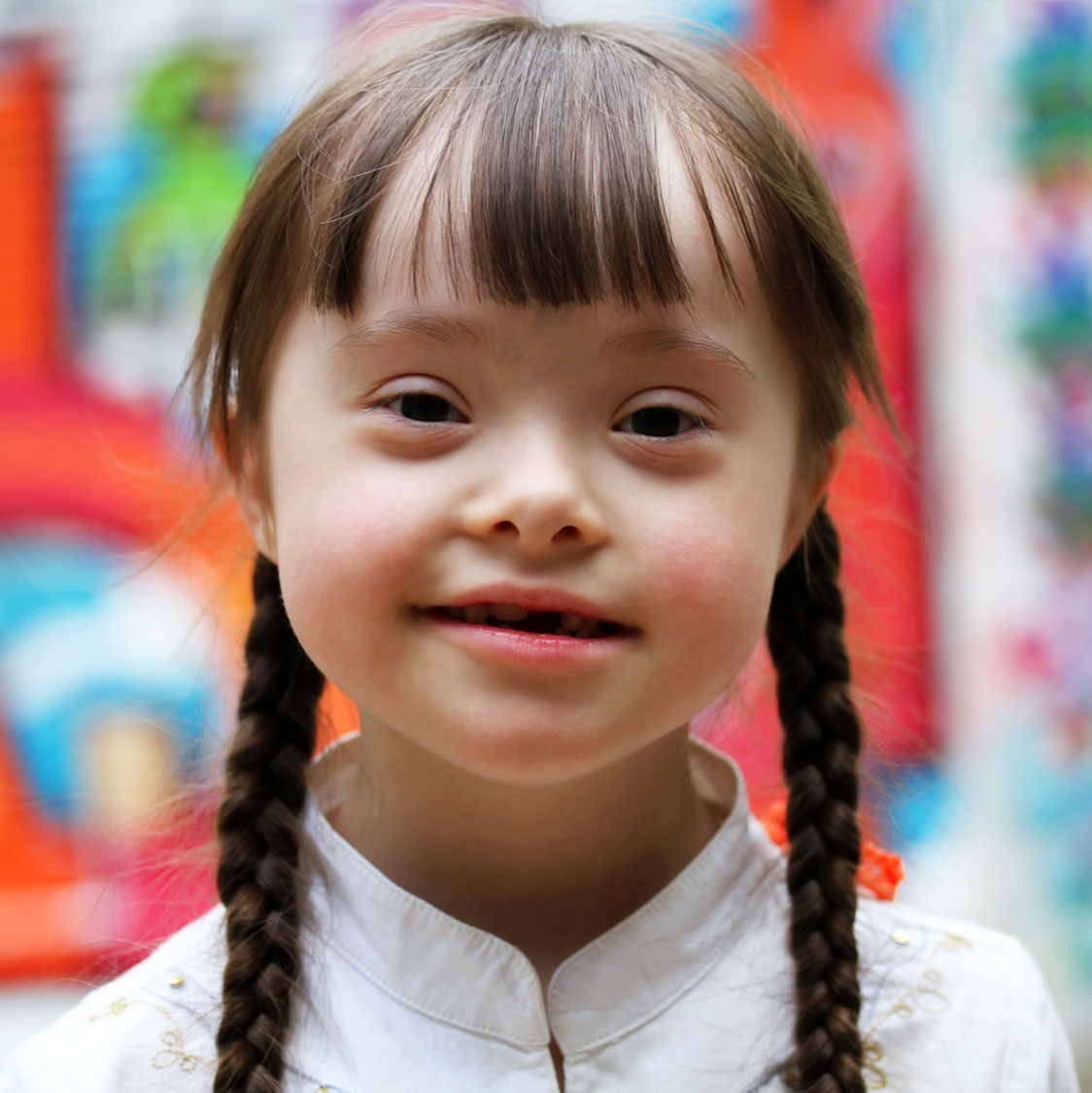 Girl with Down Syndrome